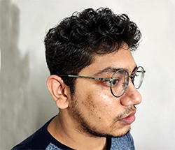 After Hair Restoration