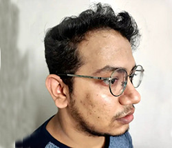 Before Hair Restoration