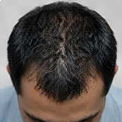 After hair treatment