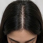 After hair treatment