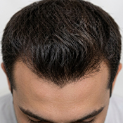After hair treatment