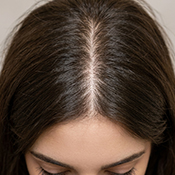 After hair treatment
