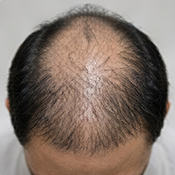 Before hair treatment