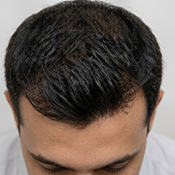 Before hair treatment