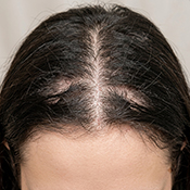 Before hair treatment